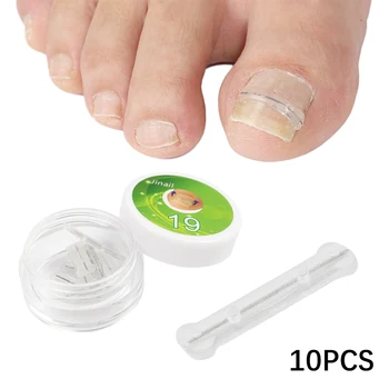 10шт Наклеек для коррекции ногтей 13-20 мм, Пластыри для коррекции вросшего ногтя, Средства для лечения Паронихии, Восстанавливающий Корректор, Инструменты для педикюра